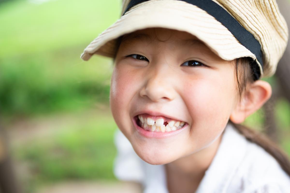 乳歯が抜けるのが早いとどうなる？　原因や歯並びへの影響は？